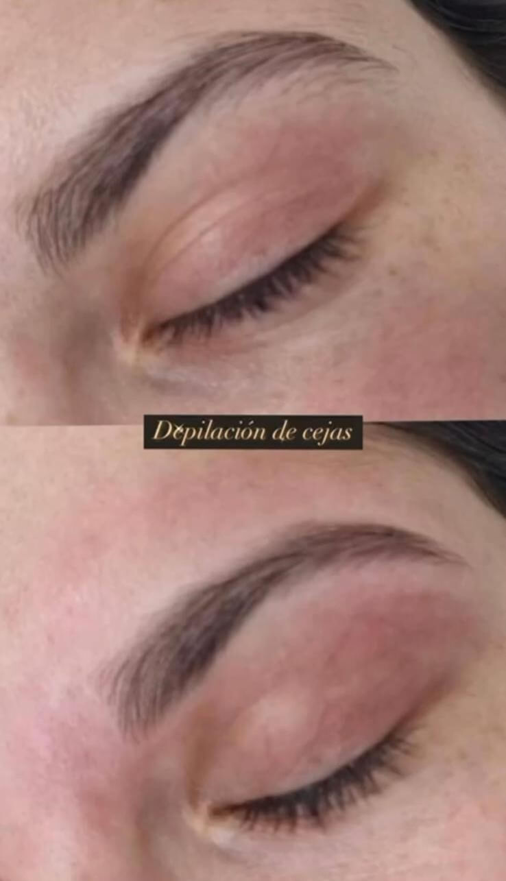 Tratamiento Hidratante 6